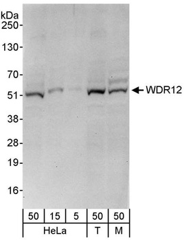 Rabbit WDR12 Antibody