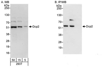 Rabbit Dcp2 Antibody