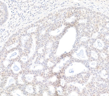 Rabbit BRD2 Antibody