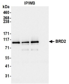 Rabbit BRD2 Antibody