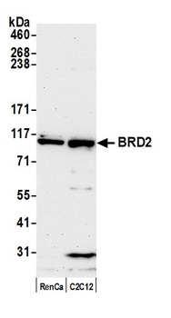Rabbit BRD2 Antibody