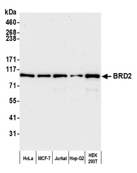 Rabbit BRD2 Antibody