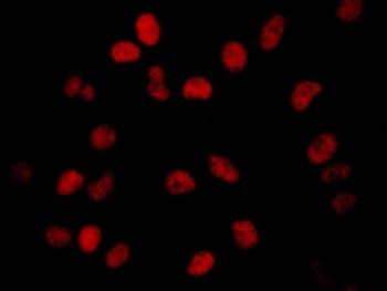 Rabbit BRD2 Antibody