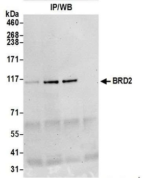 Rabbit BRD2 Antibody