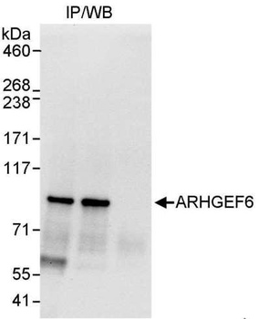 Rabbit ARHGEF6 Antibody
