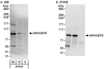Rabbit ARHGEF6 Antibody