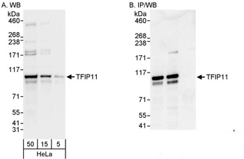 Rabbit anti-TFIP11 Antibody
