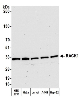 Rabbit RACK1 Antibody
