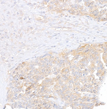 Rabbit Vinculin Antibody