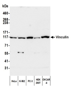 Rabbit Vinculin Antibody