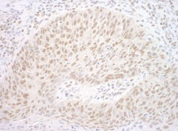 Rabbit CBX7 Antibody