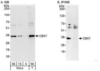 Rabbit CBX7 Antibody