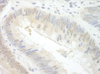 Rabbit EAF2 Antibody
