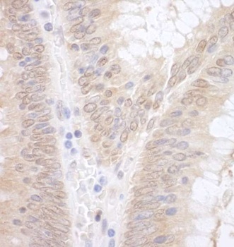 Rabbit EAF2 Antibody