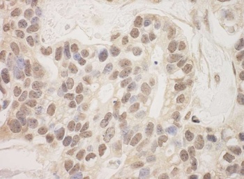 Rabbit SAP130 Antibody