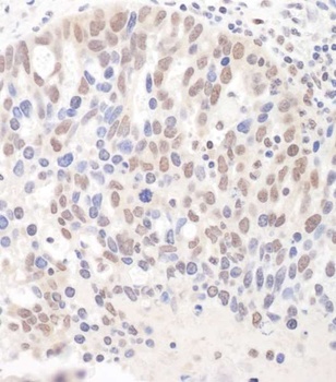 Rabbit DGCR8 Antibody
