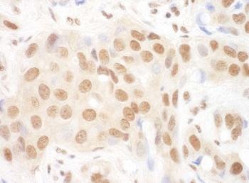 Rabbit DGCR8 Antibody