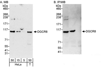 Rabbit DGCR8 Antibody