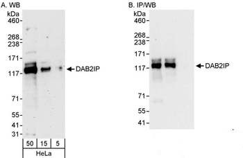 Rabbit DAB2IP Antibody