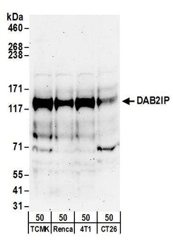 Rabbit DAB2IP Antibody