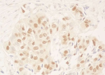 Rabbit NRIP Antibody