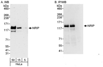 Rabbit NRIP Antibody