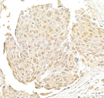 Rabbit NRIP Antibody
