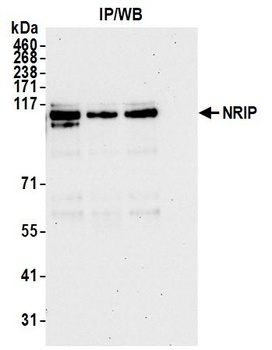 Rabbit NRIP Antibody