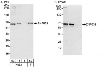 Rabbit ZNF639 Antibody