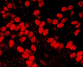 Rabbit HMGN1 Antibody