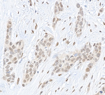 Rabbit Pc2 Antibody