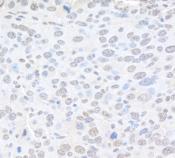 Rabbit Pc2 Antibody