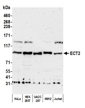 Rabbit ECT2 Antibody