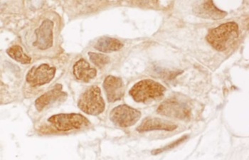 Rabbit TIGAR Antibody