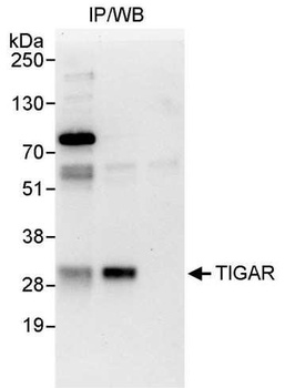 Rabbit TIGAR Antibody