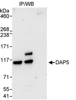 Rabbit DAP5 Antibody
