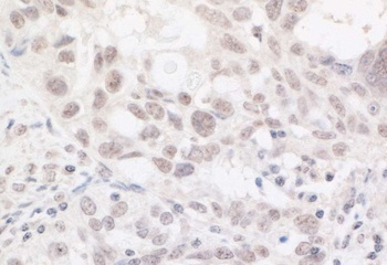 Rabbit ARID2 Antibody