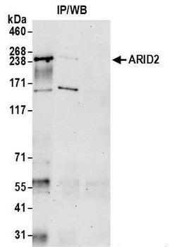Rabbit ARID2 Antibody