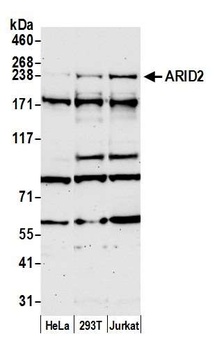 Rabbit ARID2 Antibody