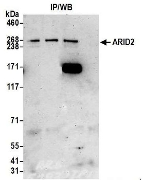Rabbit ARID2 Antibody