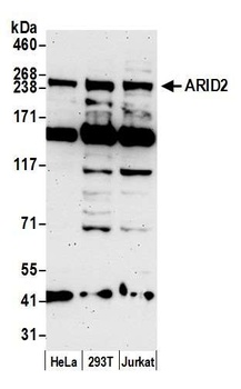 Rabbit ARID2 Antibody