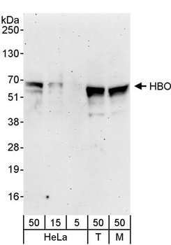Rabbit HBO Antibody