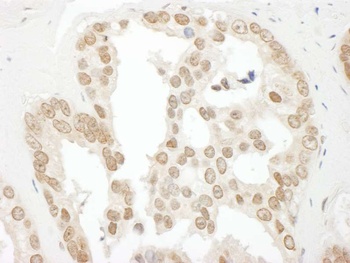 Rabbit BCCIP Antibody