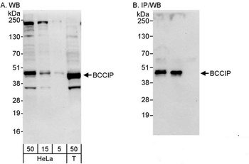 Rabbit BCCIP Antibody