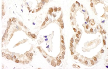 Rabbit FANCD2 Antibody