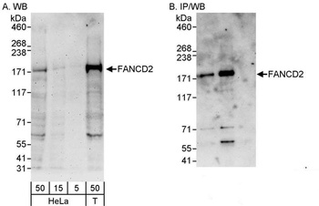 Rabbit FANCD2 Antibody