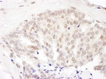 Rabbit Cul5 Antibody