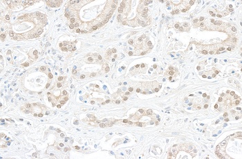 Rabbit BOP1 Antibody