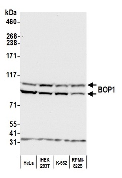 Rabbit BOP1 Antibody