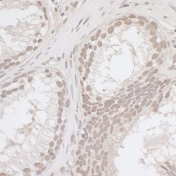 Rabbit E2F4 Antibody